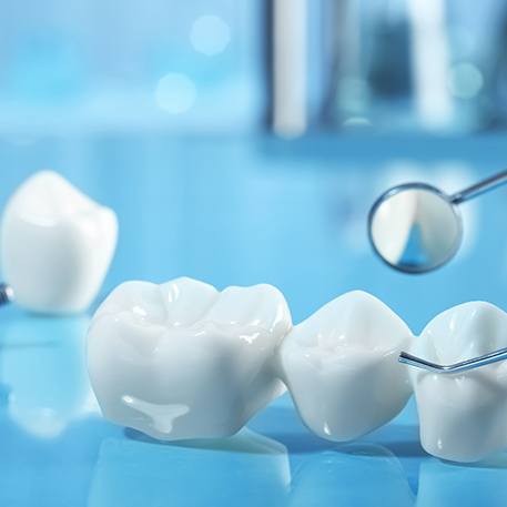 Dental implant, crown, and bridge with dental instruments on reflective blue surface