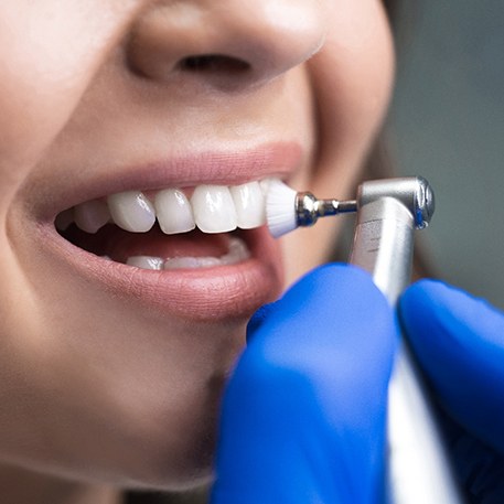 Your dental team will clean and polish your teeth at your dental cleaning	
