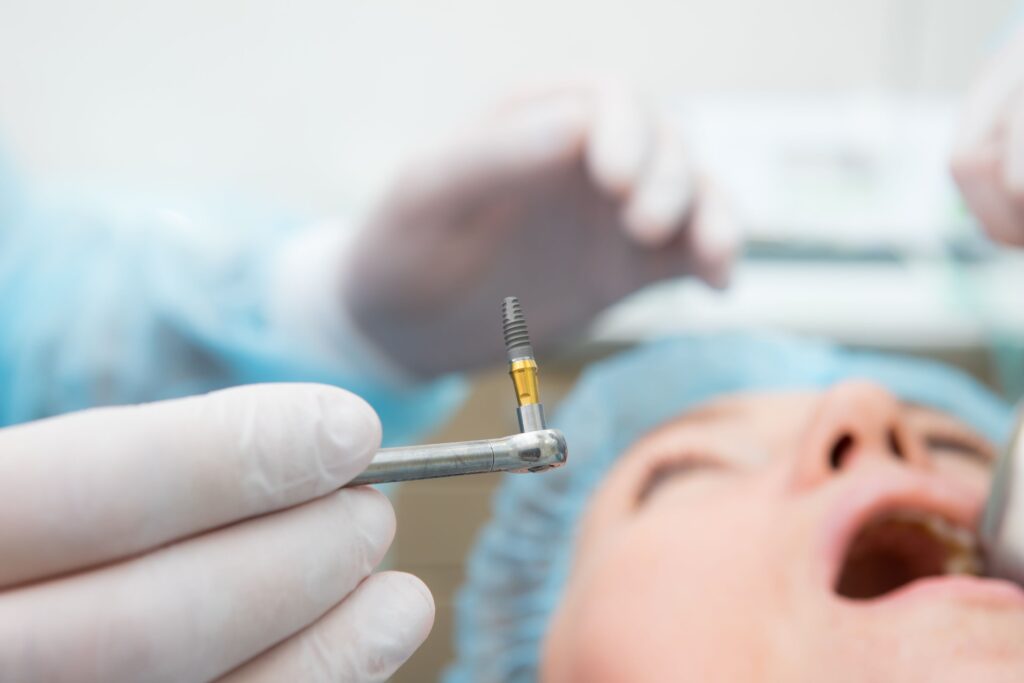 Close up of dental implant about to be surgically placed in patient's mouth