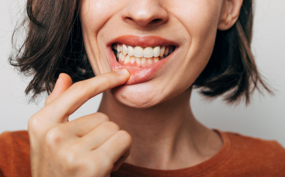 Woman pulling down lip to show gums